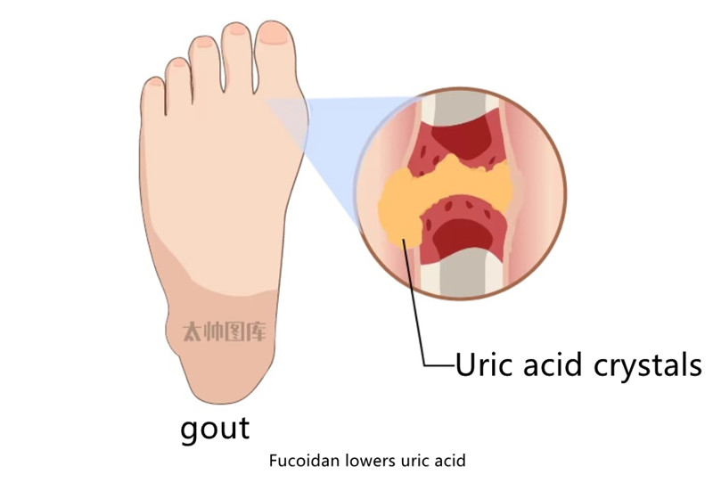 Fucoidans ability to lower uric acid is more than just 