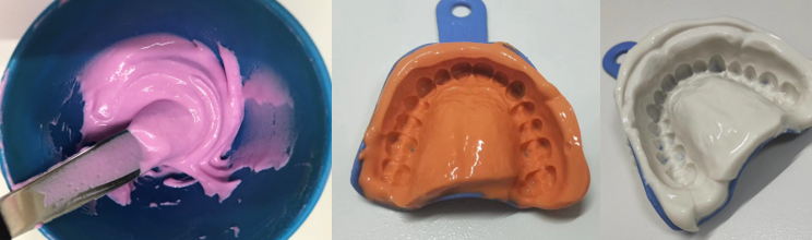 alginate dental impression.png